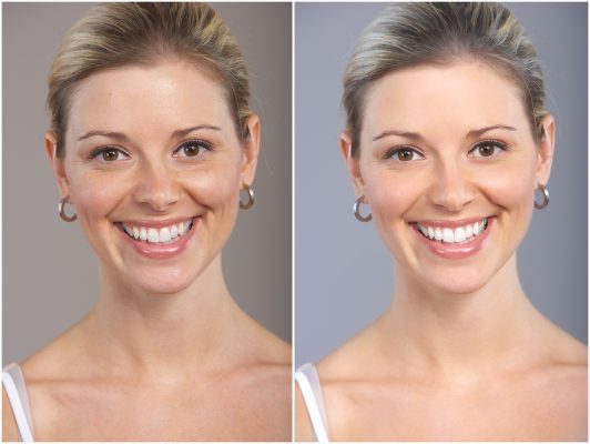 Cosmetic Dentistry: The Latest Advances in Smile Makeovers